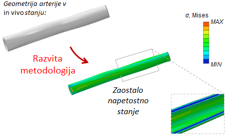 Zaostale napetosti v arteriji